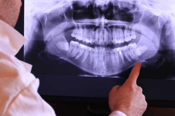 Best Broken or Cracked Tooth Emergency Dentist in Wellsville, UT
