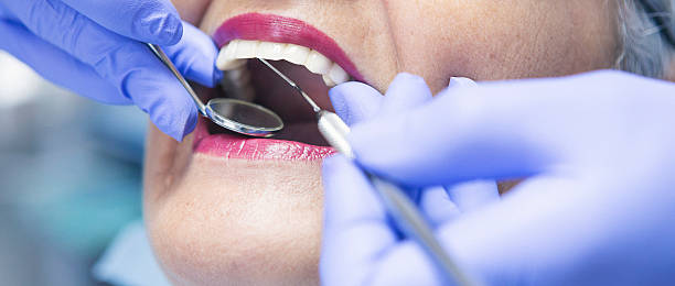 Best Emergency Dentist for Lost Fillings or Crowns in Wellsville, UT